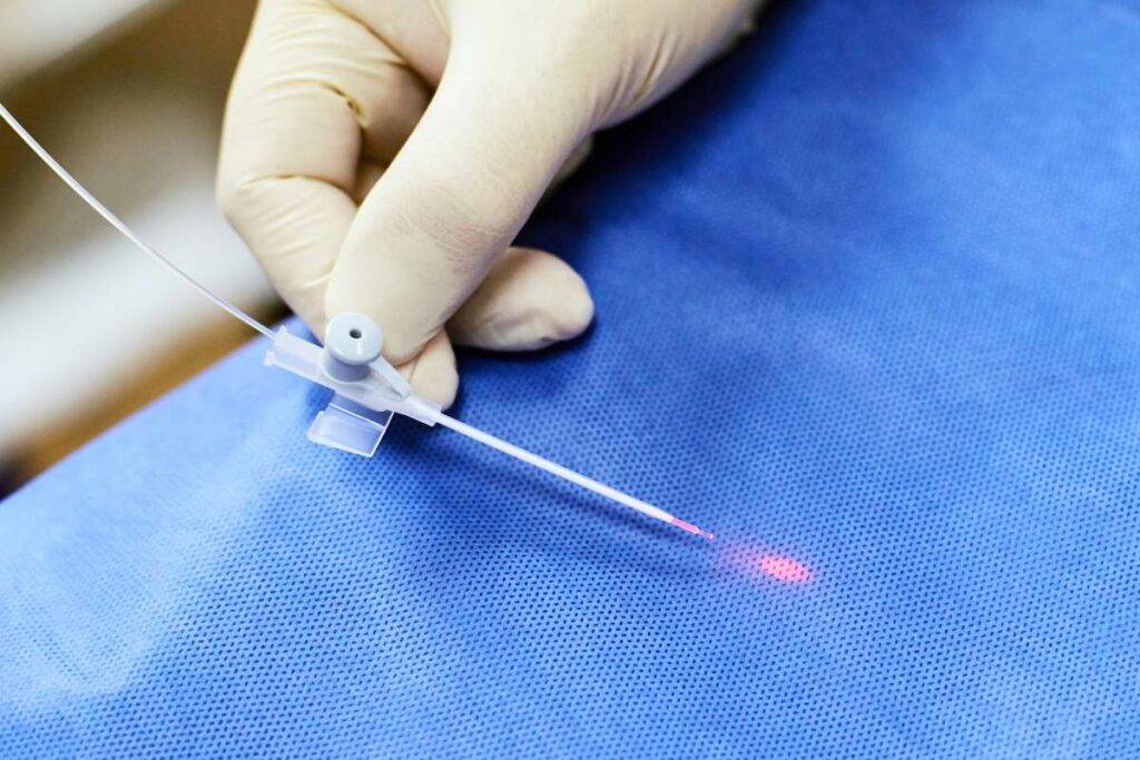 Cirurgia de varizes com laser