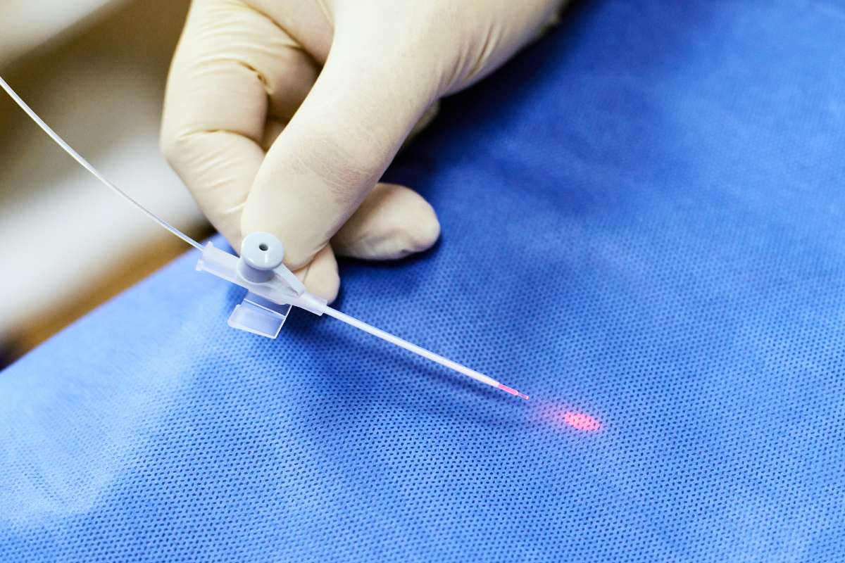 Cirurgia de varizes com laser