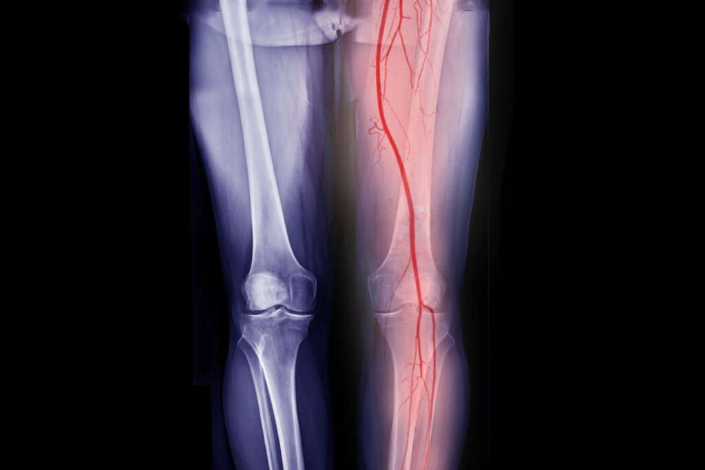 melhor médico vascular londrina