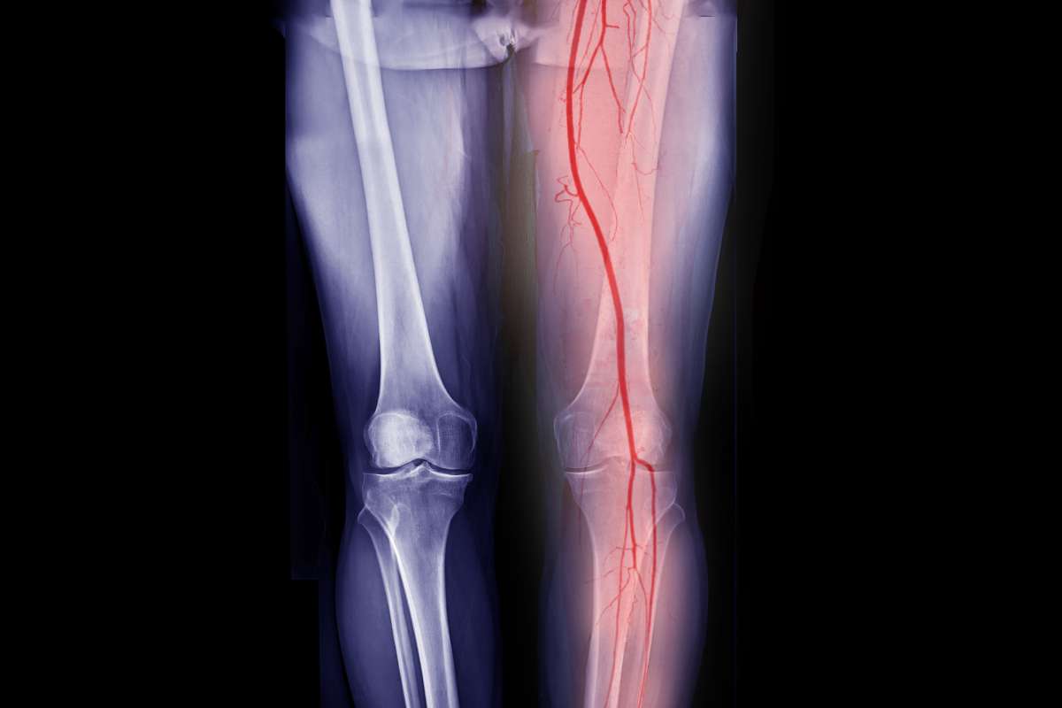 melhor médico vascular londrina